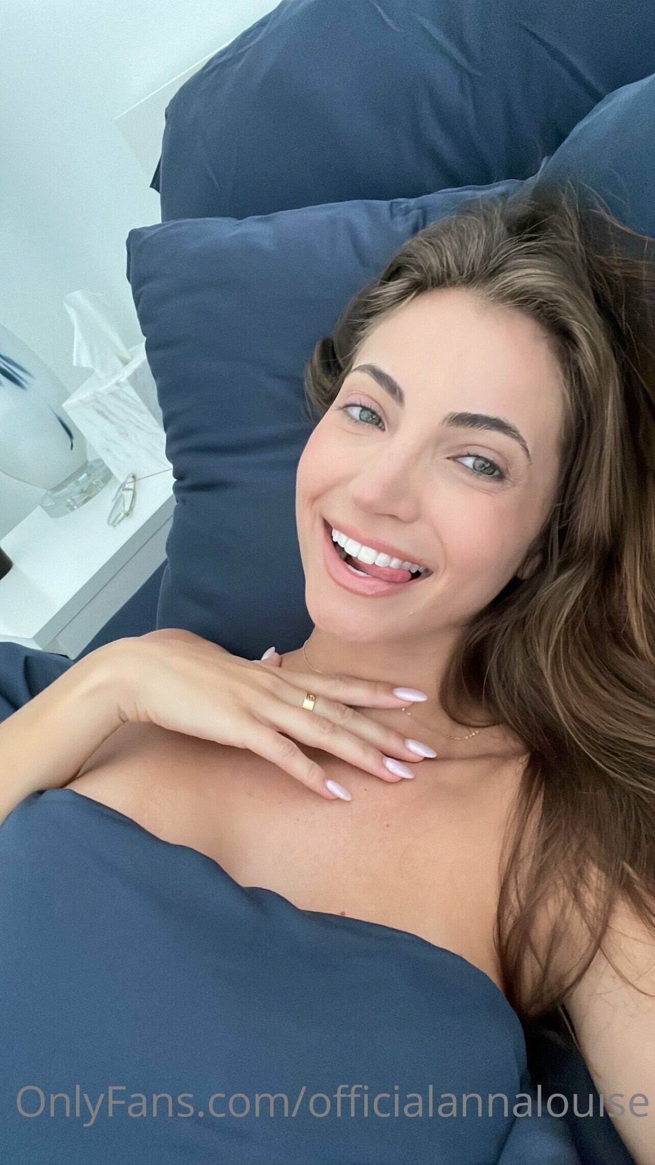 Photo 49 of Anna Louise